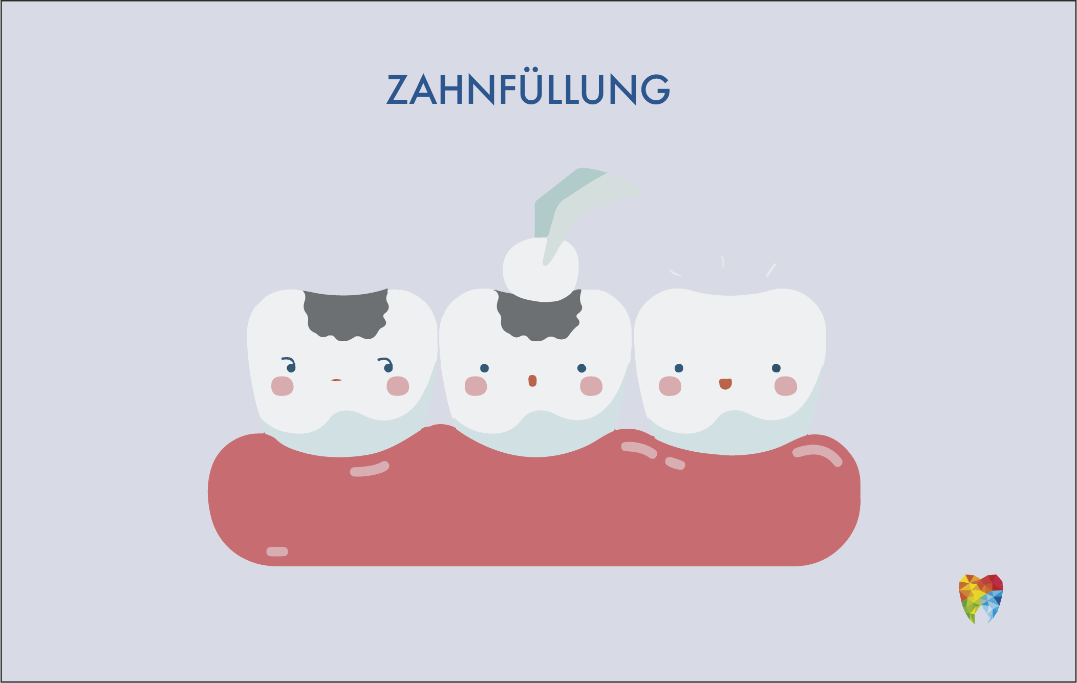 zahnfüllung