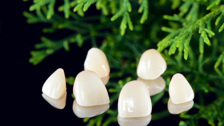 Veneers Schmerzen Header