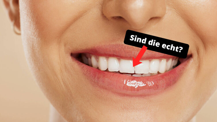 Weiße Zähne